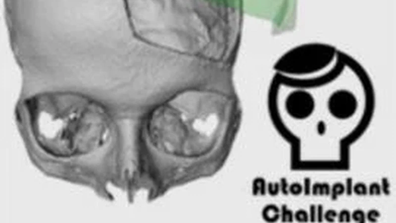 AutoImplant