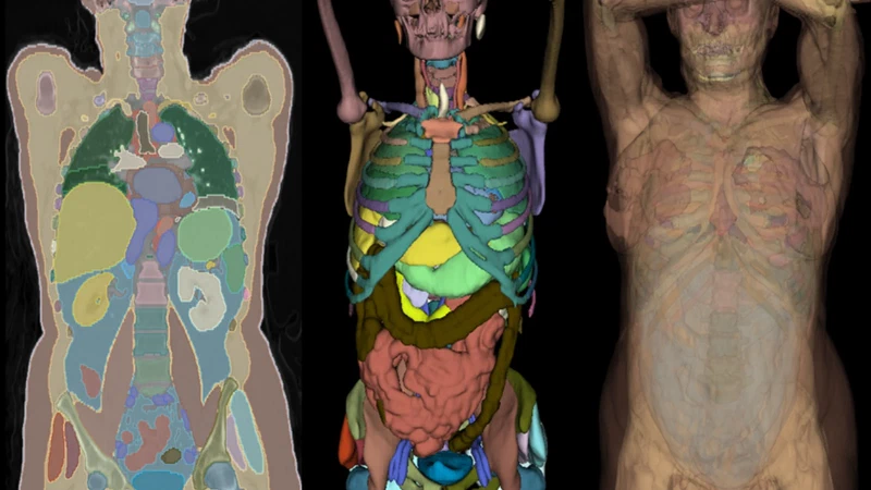 Full Body Anatomy Segmentation
