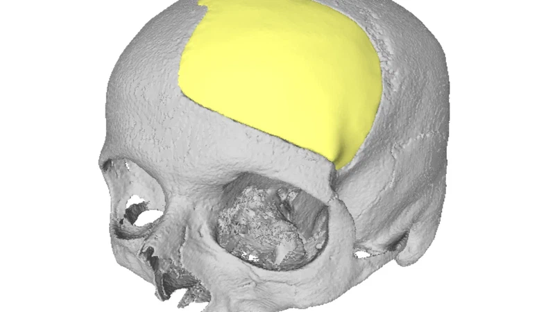 MedShapeNet