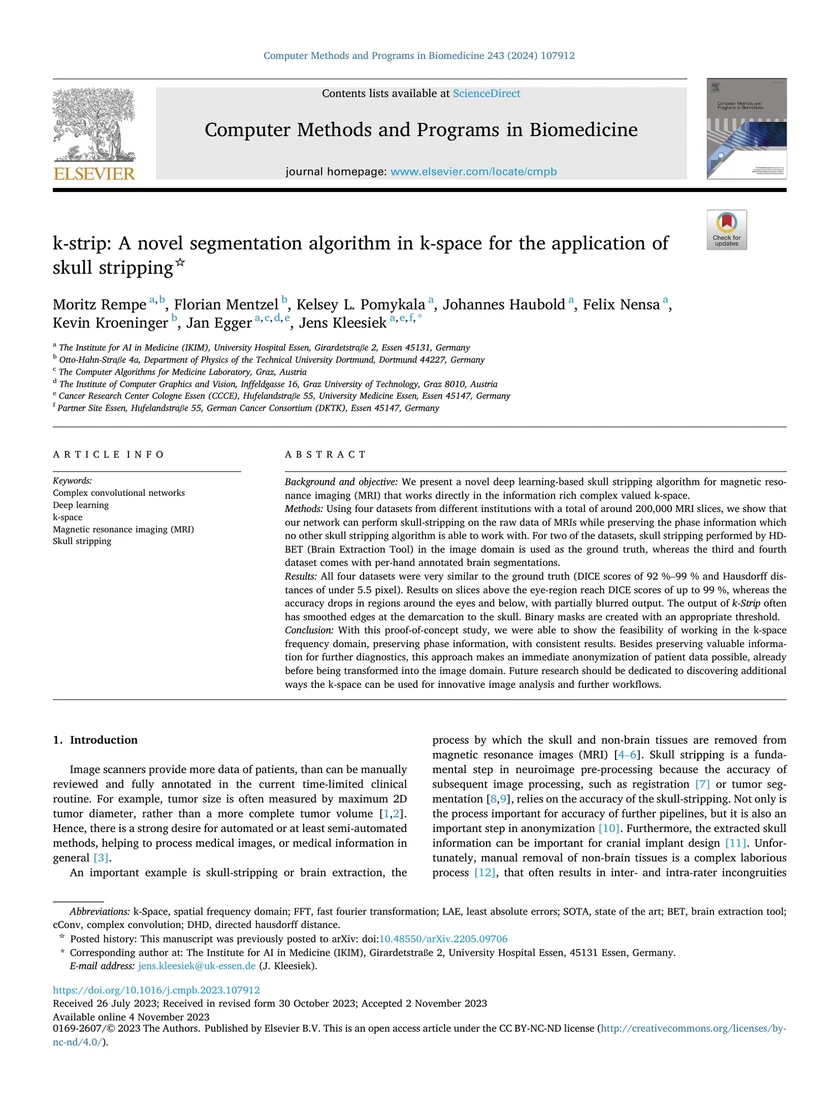 k-strip: A novel segmentation algorithm in k-space for the application of skull stripping