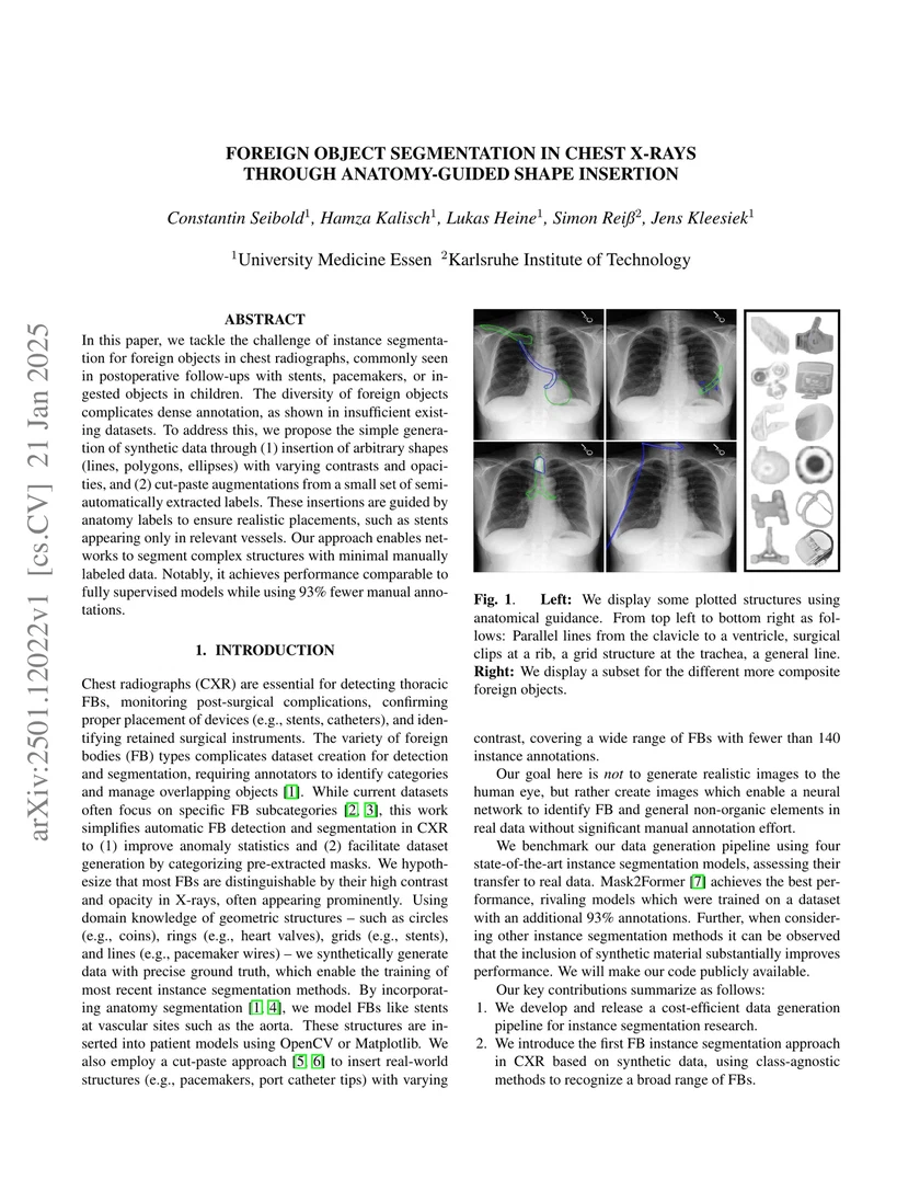 Foreign object segmentation in chest x-rays through anatomy-guided shape insertion